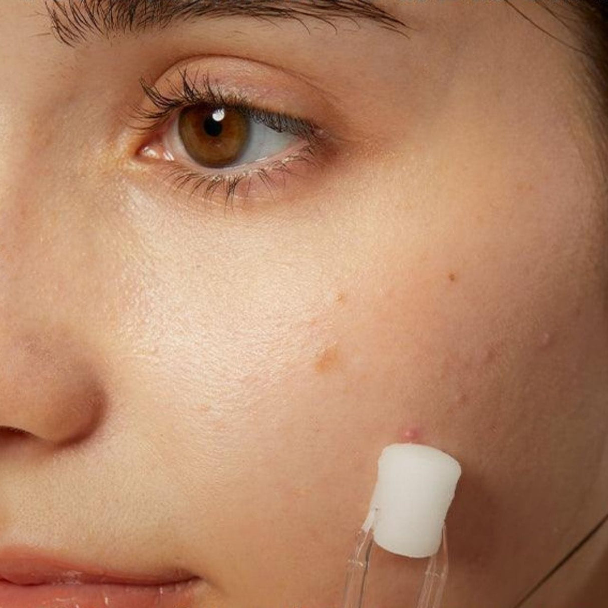 COSRX The AHA 2 BHA 2 Blemish Treatment Serum - 50 g